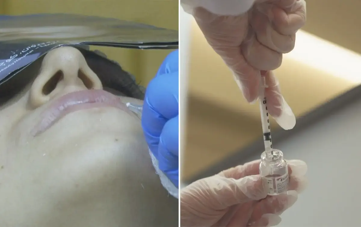 دائرة صحة كركوك: معاقبة 3 – 4 صالونات تجميل أسبوعياً بسبب “الفيلر” و”البوتوكس”