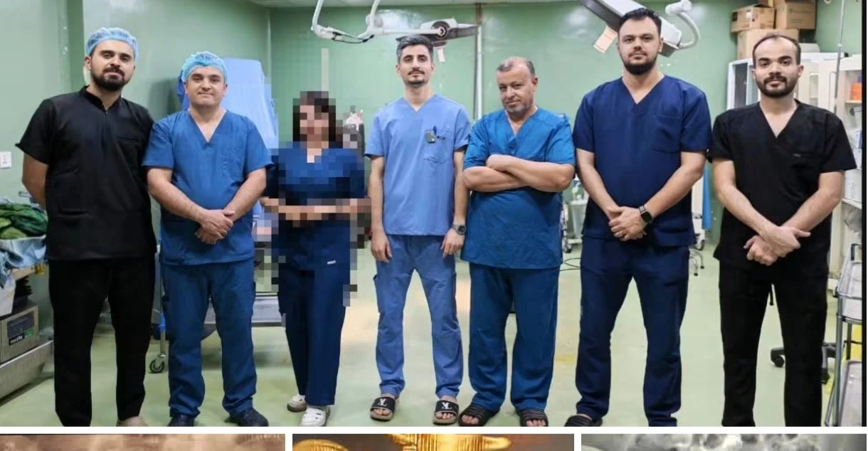 كركوك عملية نوعية لتثبيت حوض شاب تعرض لحادث دهس بجرار زراعي